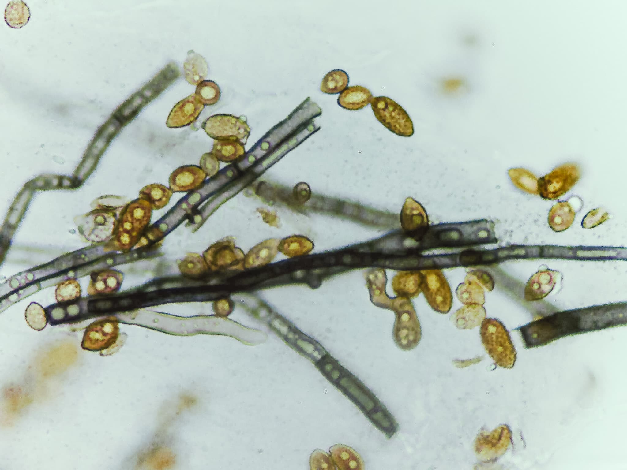 Microscopy of fungal endophyte hyphae and spores